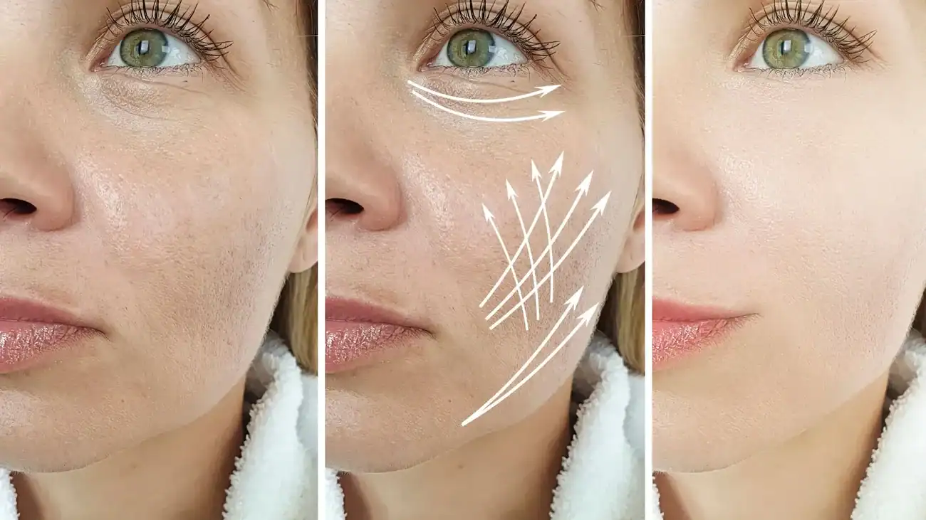 Can One Treatment Really Tackle More Than One Skin Concern West Bridgford?