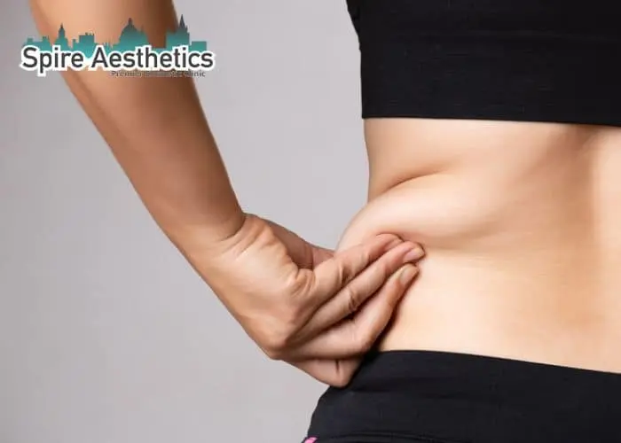 Image of woman pinching fat on their hips West Bridgford. Fat Freezing treatment