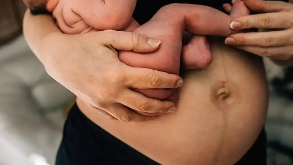 Why Is My Stomach Still Big After Pregnancy West Bridgford?